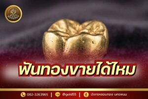 ฟันทองขายได้ไหม