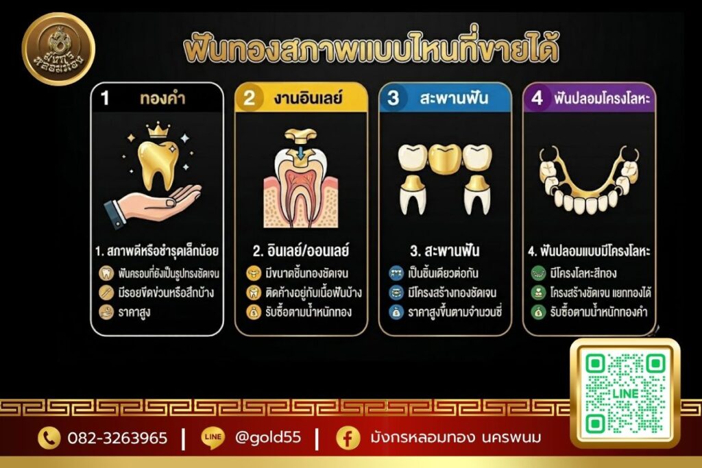 ฟันทองสภาพแบบไหนที่ขายได้